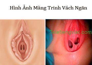 Cách bước kiểm tra màng trình bị rách nát